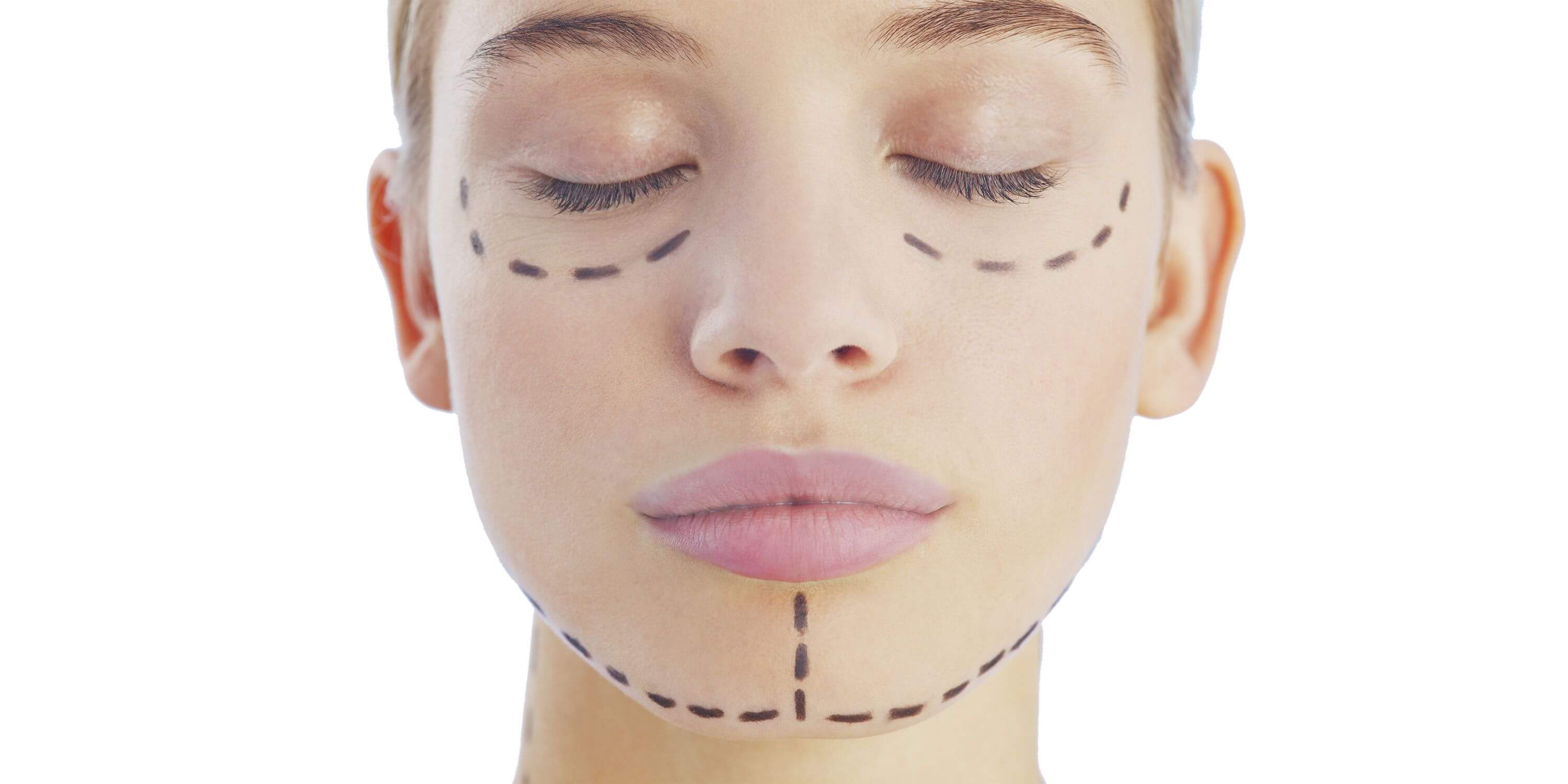 Cosmetic-face-lift